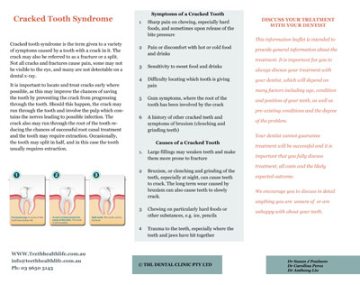 Cracked Teeth Syndrome
