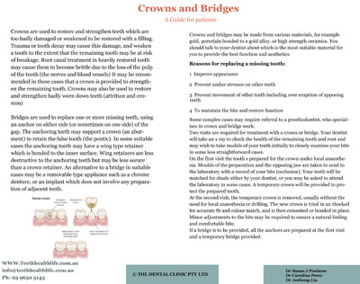 Crowns and Bridges